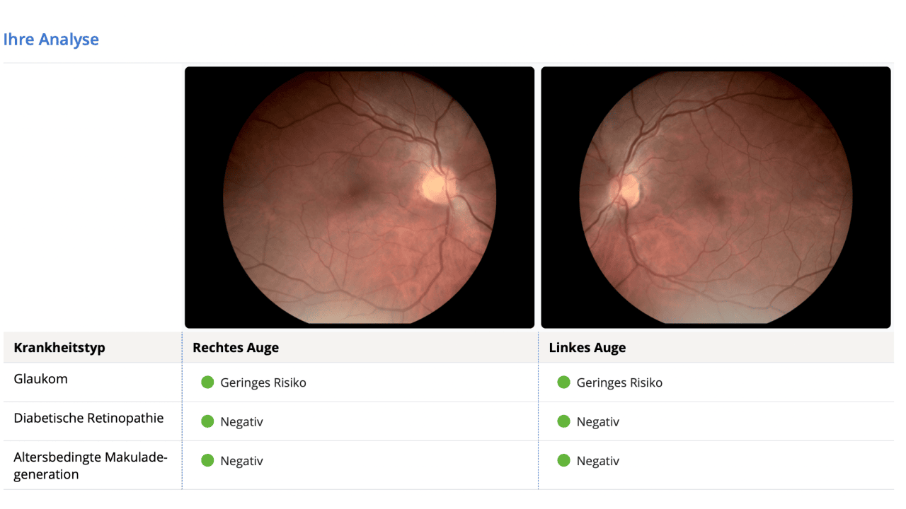 Auswertung Augenkrankheiten