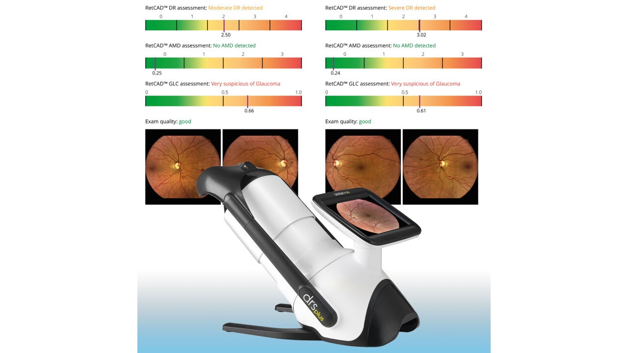 iCare DRSplus + ILLUME = Netzhaut-Screening mit vollautomatischer Bilderfassung und integrierter K.I. Auswertung 