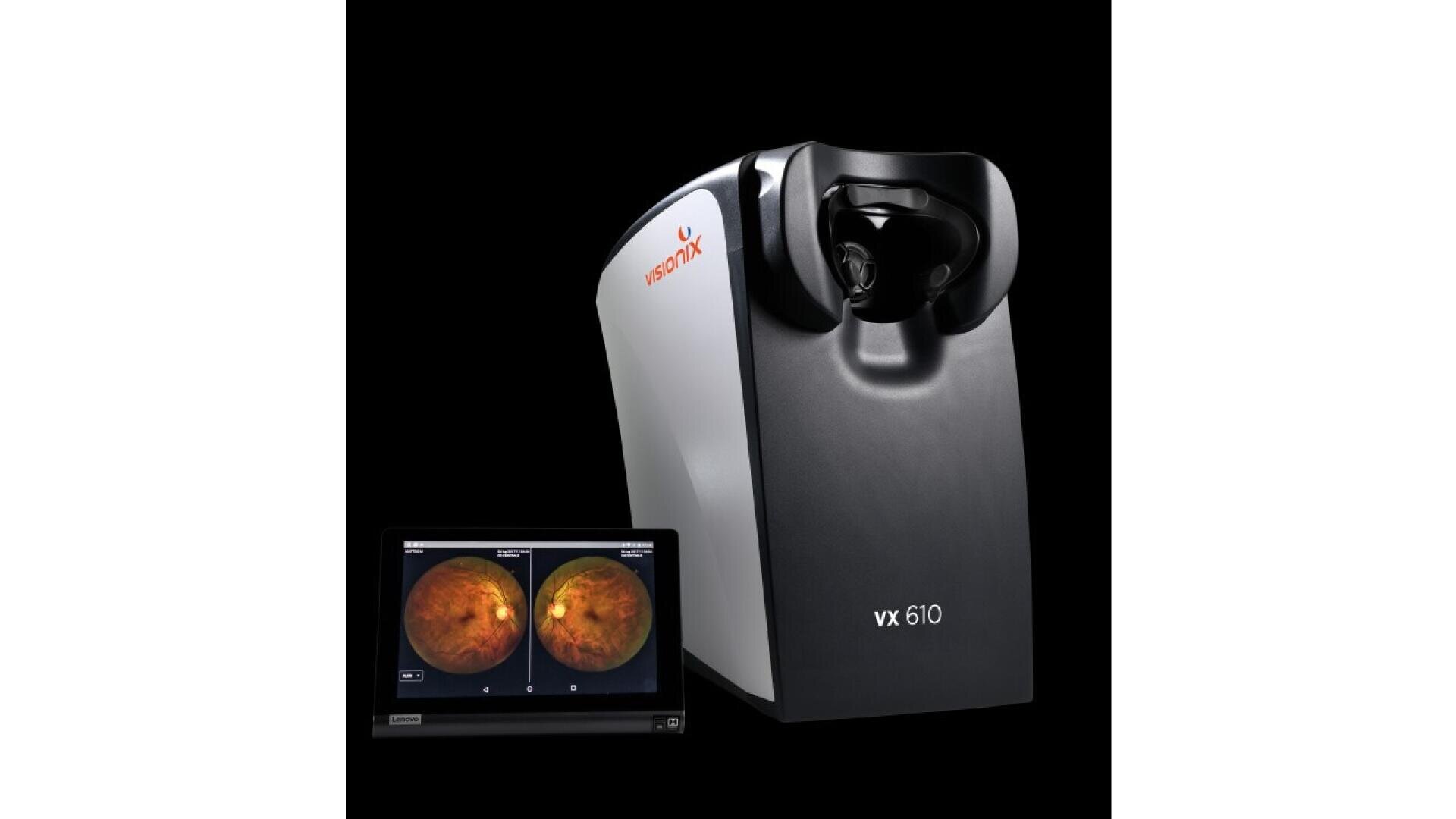 A medical imaging device labeled vx 610 next to a monitor displaying two retinal eye scans, both against a black background.