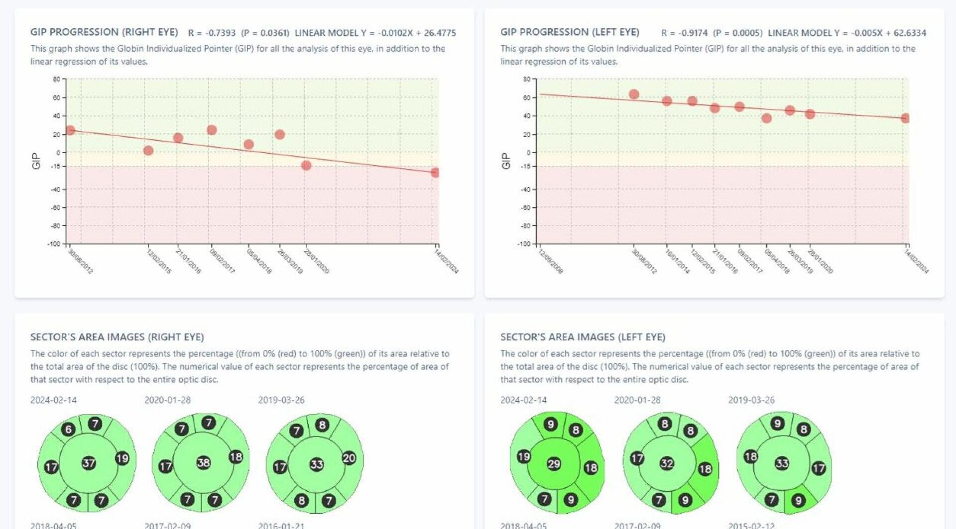 Vier Datentafeln: Die oberen beiden zeigen Liniendiagramme mit der Bezeichnung „GIP-Progression“ für das rechte und linke Auge mit Abwärtstrends. Die unteren beiden zeigen Kreisdiagramme, die Sektorbereichsbilder in Grün über fünf Zeitpunkte verfolgen.