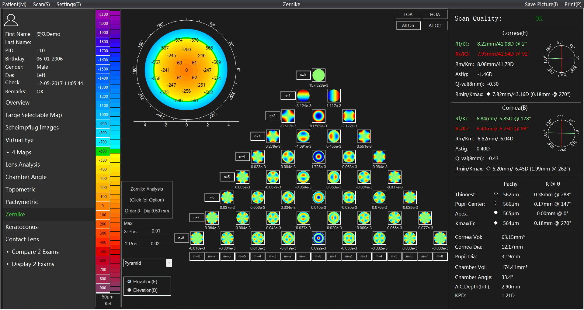 Auf einem Computerbildschirm wird eine detaillierte Hornhauttopographie-Analyse mit mehreren farbkodierten Karten, numerischen Daten und Kreisdiagrammen angezeigt, die die Form und Dicke der Hornhaut eines Patienten namens John Doe illustrieren.