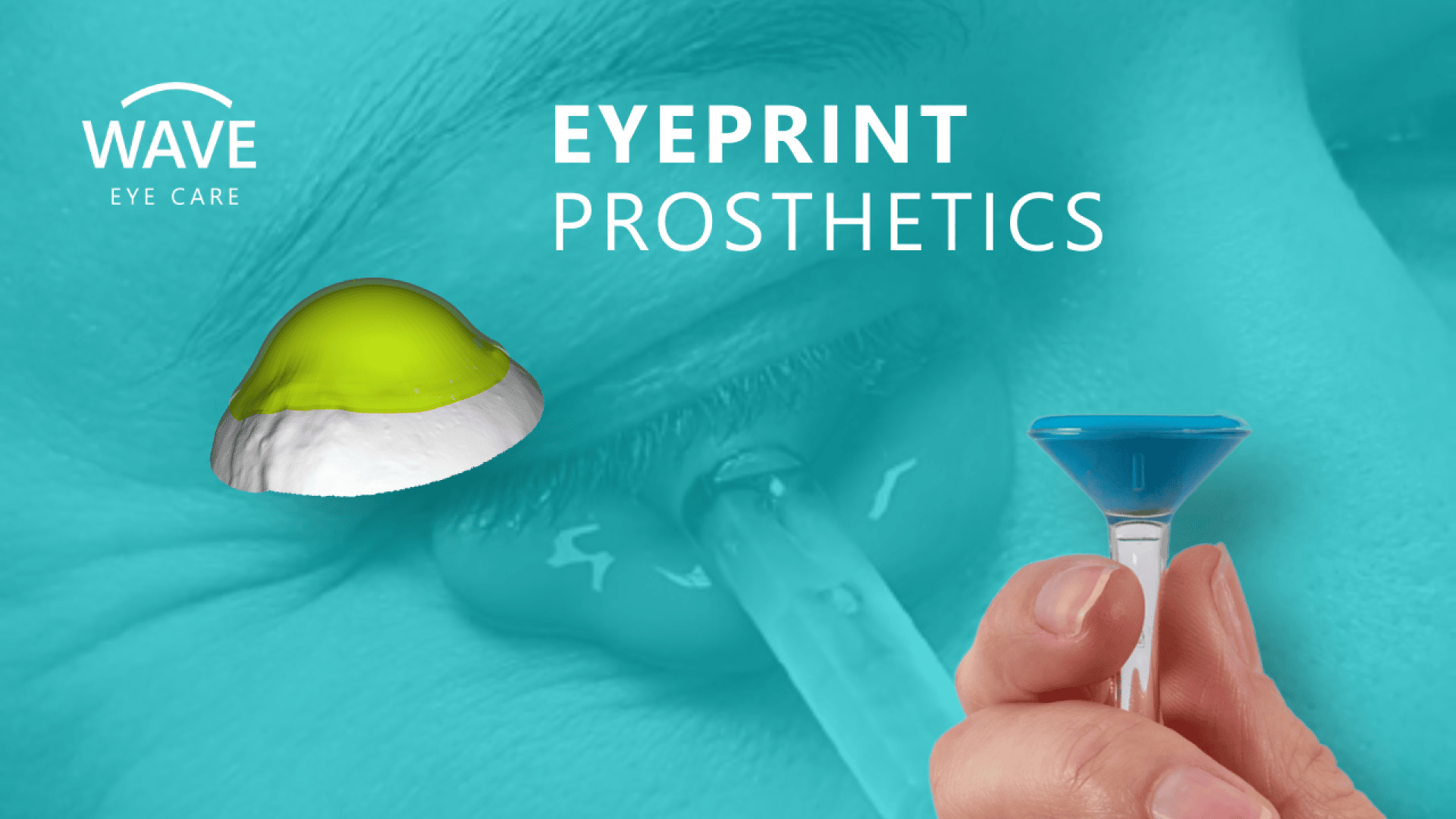 Close-up of an eye being fitted for a prosthetic lens, with a hand holding a blue tool and a digital model of a custom-made lens. The text reads WAVE EYE CARE EYEPRINT PROSTHETICS.