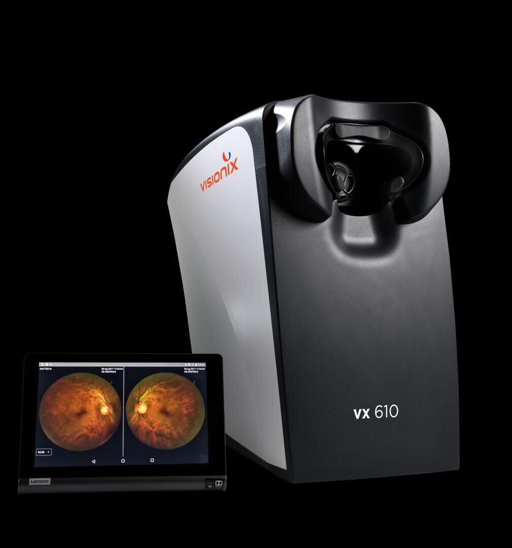 Neben einem Tablet, auf dessen Bildschirm Netzhautbilder angezeigt werden, ist ein Augendiagnosegerät Visionix VX 610 zu sehen, alles vor einem schwarzen Hintergrund.