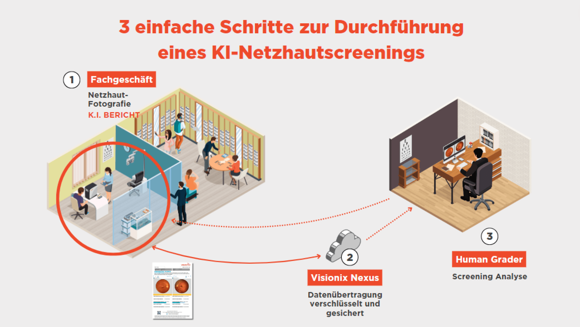 Infografik, die drei Schritte des KI-basierten Netzhautscreenings zeigt: (1) Netzhautfoto im Geschäft, (2) verschlüsselte Daten, die über Visionix Nexus gesendet werden, (3) Screening-Analyse durch einen menschlichen Beurteiler an einem Computer.