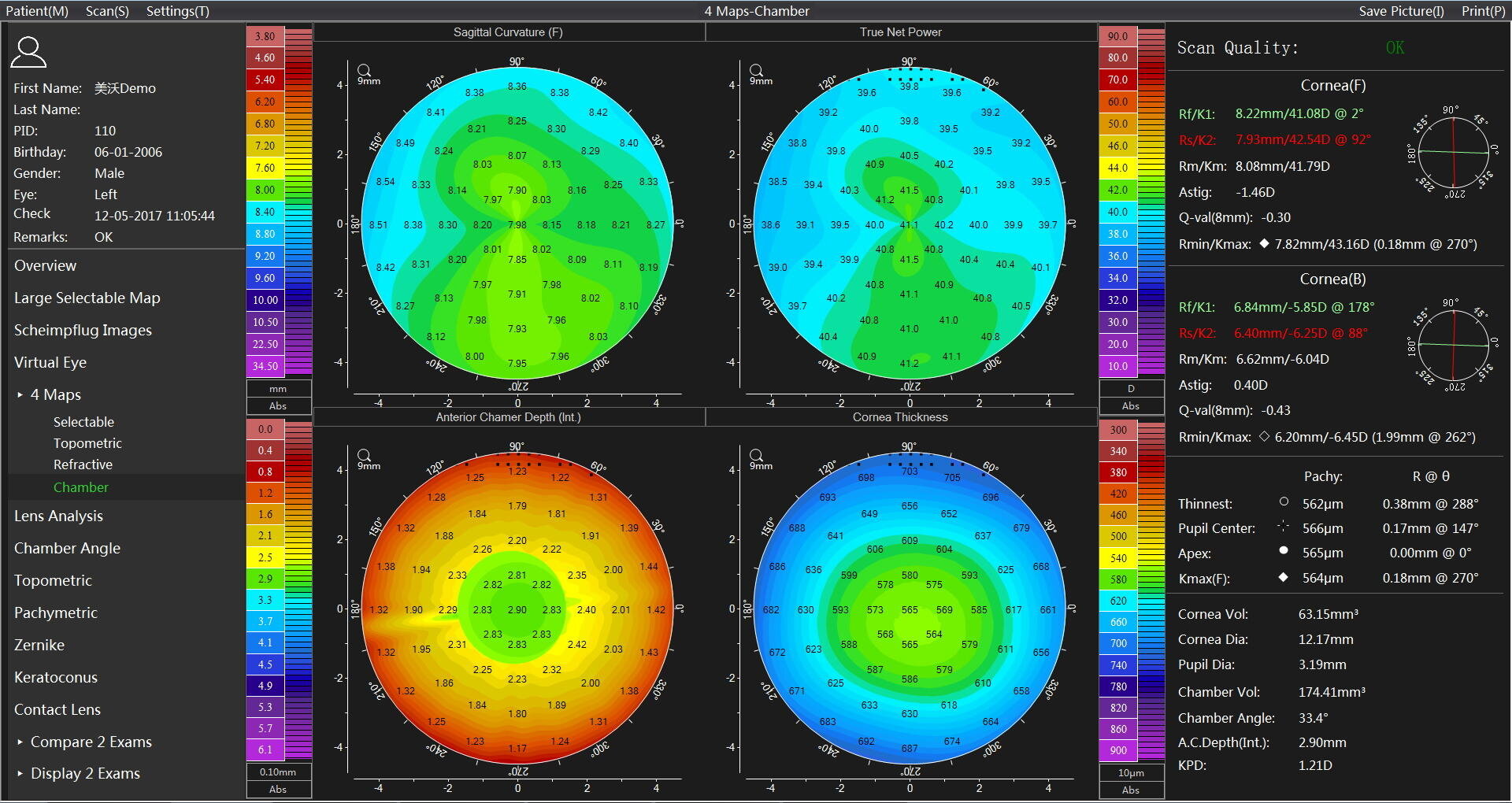 Bei einem Hornhauttopographie-Scan werden vier farbige Karten und detaillierte numerische Daten angezeigt, die die Hornhautkrümmung, -dicke und -erhebung für beide Augen sowie Analysewerkzeuge und Scan-Qualitätsindikatoren auf einem schwarzen Hintergrund darstellen.