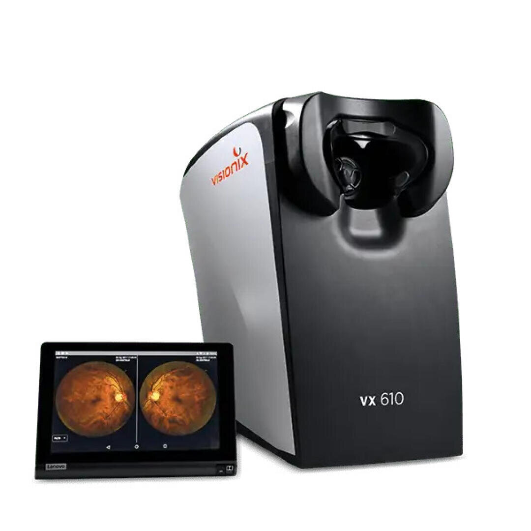 Neben einem Bildschirm, auf dem zwei Netzhautbilder angezeigt werden, steht ein Augenuntersuchungsgerät Visionix VX 610, das für erweiterte Diagnosen und Beurteilungen der Augengesundheit verwendet wird.