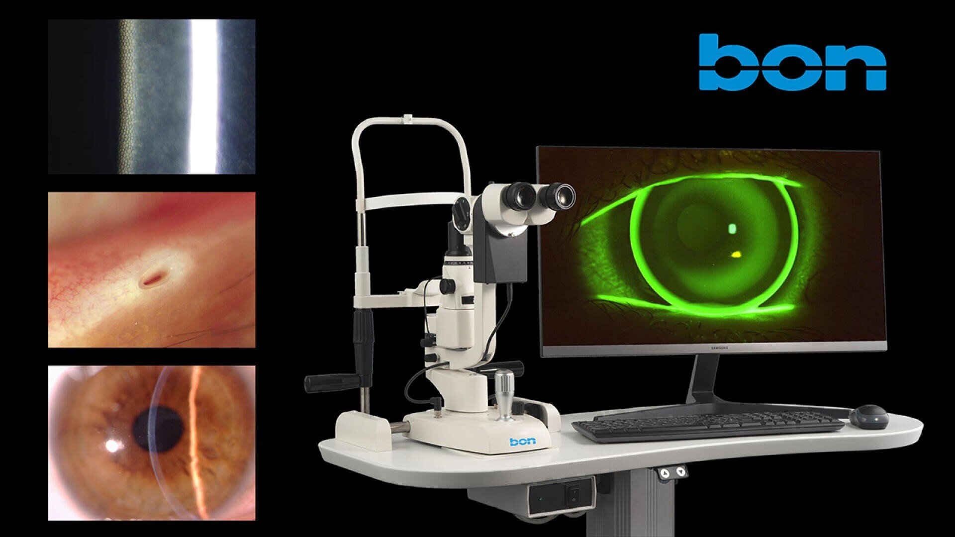 Ein Spaltlampen-Biomikroskop steht auf einem Tisch neben einem Monitor, auf dem ein grün leuchtendes Auge zu sehen ist. Auf der linken Seite sind drei Nahaufnahmen des Auges zu sehen, und in der rechten oberen Ecke erscheint das bon-Logo.