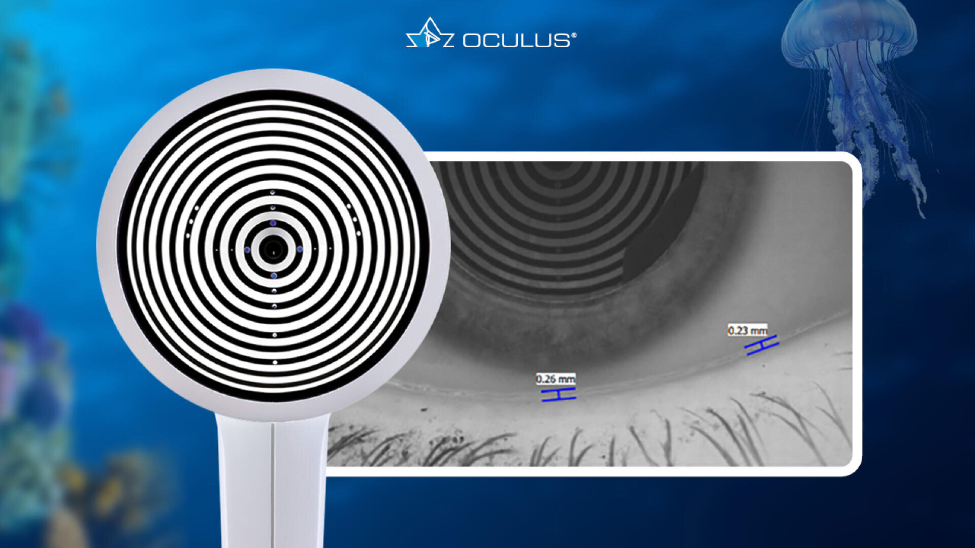 Links ist ein medizinisches Gerät mit konzentrischen schwarzen und weißen Ringen zu sehen, rechts ein Bild einer Augenuntersuchung mit Messmarkierungen; darüber erscheint das Oculus-Logo auf einem blauen Hintergrund mit Meeresmotiven.