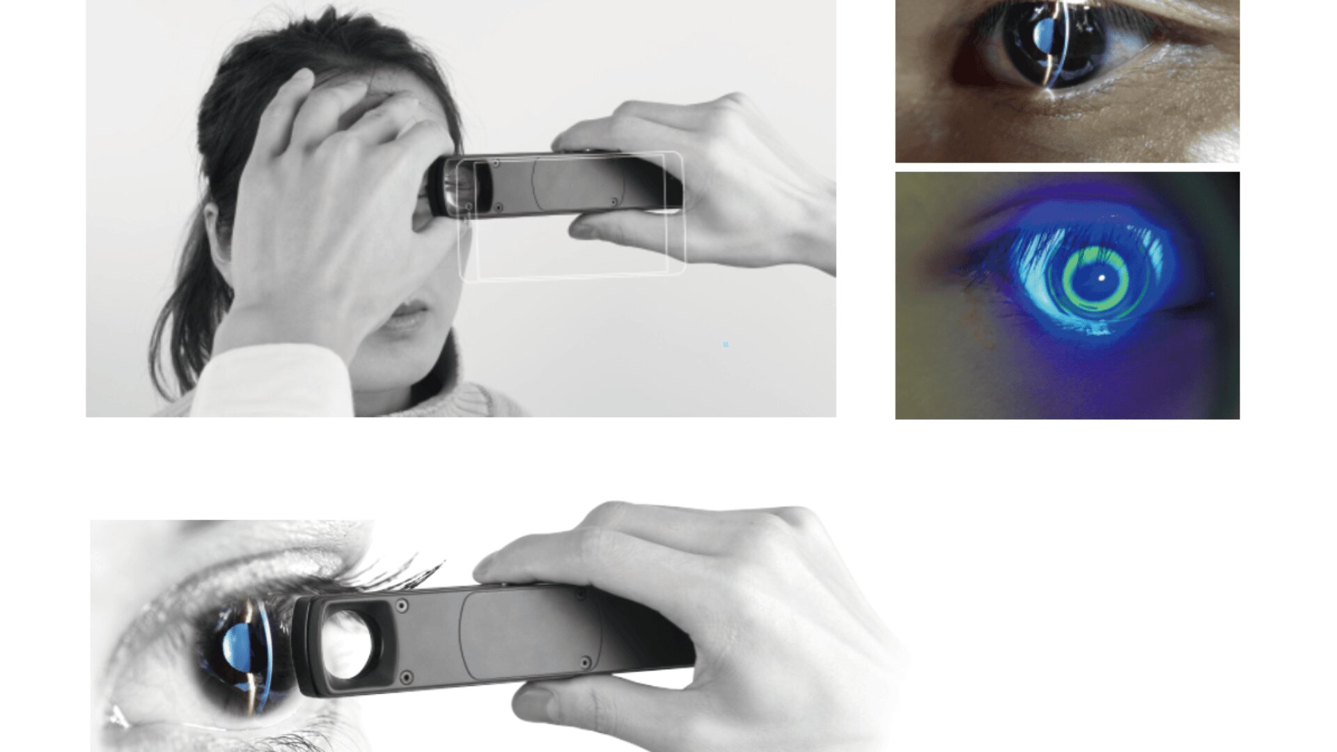 Eine Person verwendet ein tragbares Augenuntersuchungsgerät und hält es nah an ihr Auge. Weitere Nahaufnahmen zeigen, wie ein Auge mit blauem Licht beleuchtet wird und das Gerät auf das Auge fokussiert.