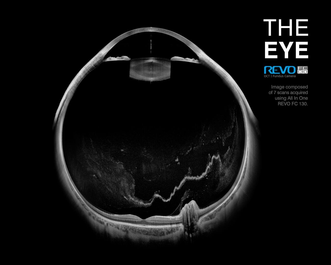 Schwarz-Weiß-Querschnittsaufnahme eines menschlichen Auges mit einem OCT-Bildgebungsgerät, die detaillierte innere Augenstrukturen zeigt. Der Text auf der rechten Seite lautet: THE EYE, REVO und Scan-Informationen.