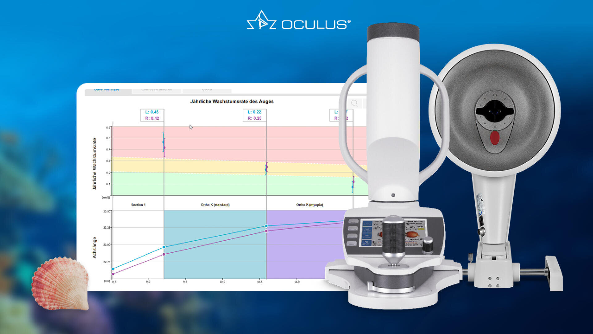 Vor einem blauen Hintergrund mit dem Oculus-Logo und einer Muschel in der linken unteren Ecke erscheinen ein Augendiagnosegerät und ein Monitor, auf dem eine deutsche Augenwachstumstabelle angezeigt wird.
