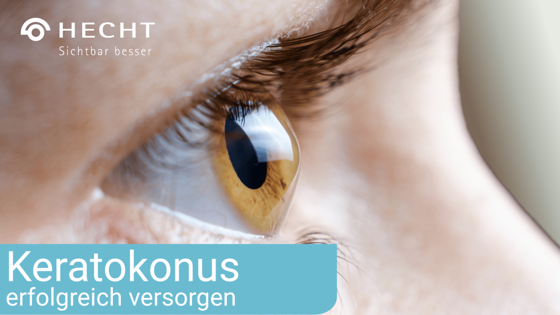 Nahaufnahme eines menschlichen Auges, das nach vorne schaut, wobei die umgebende Haut und die Wimpern sichtbar sind. Der Text auf Deutsch lautet: Keratokonus erfolgreich versorgen und HECHT Sichtbar besser.