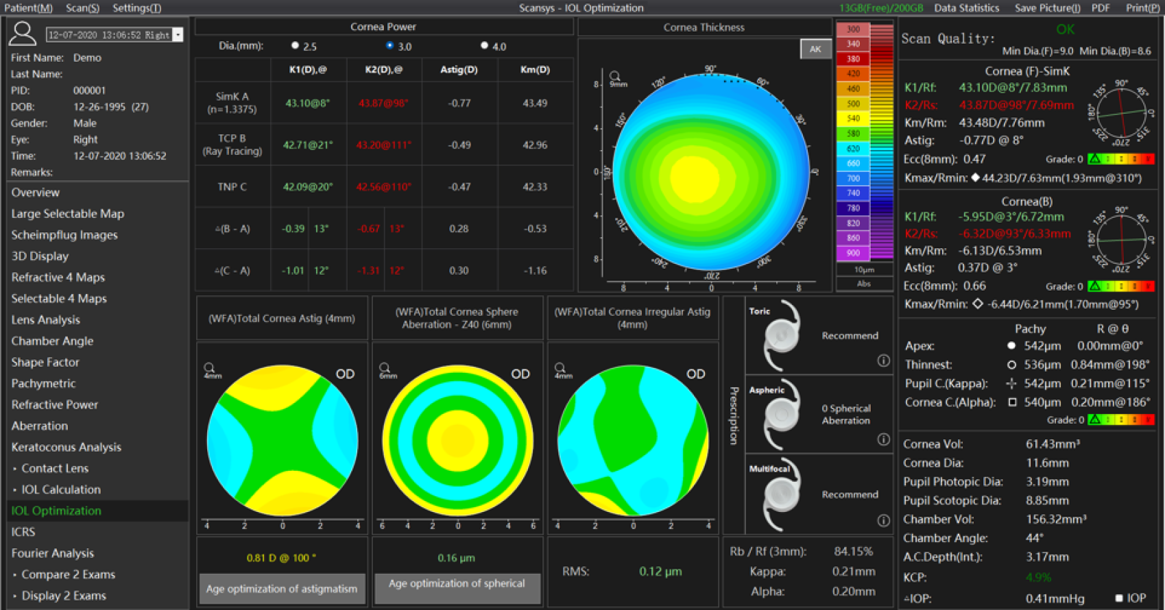 Screenshot einer Hornhauttopographie-Analyse mit detaillierten Karten der Hornhautstärke und -dicke, farbigen Konturdiagrammen, numerischen Daten und Metriken zur Scanqualität auf einer dunklen Oberfläche für die ophthalmologische Beurteilung.